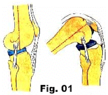 Incidência de lesões de joelho e tornozelo em Voleibol