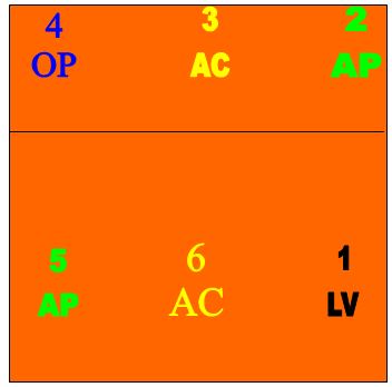 4 formas de jogar vôlei